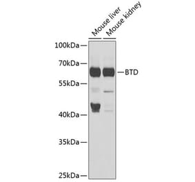 Western Blot - Anti-BTD Antibody (A16864) - Antibodies.com