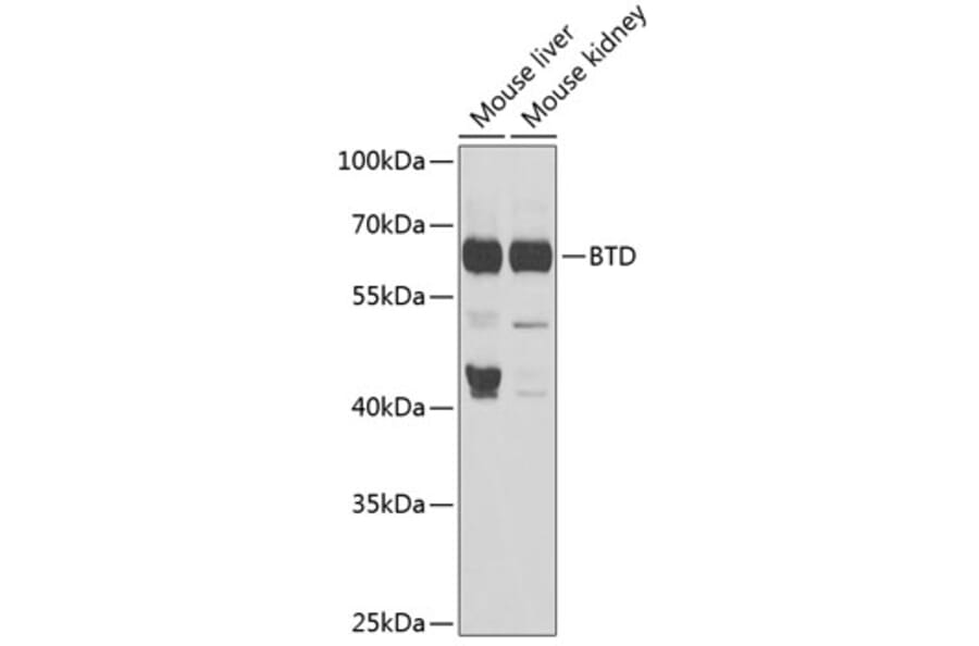 Western Blot - Anti-BTD Antibody (A16864) - Antibodies.com