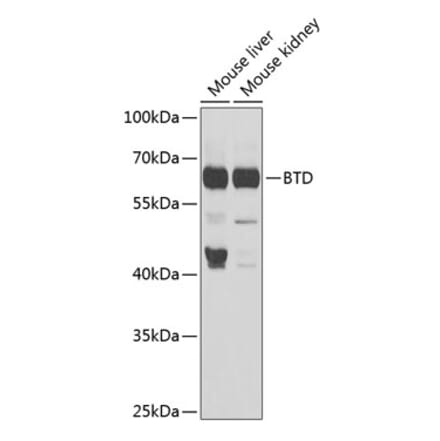 Western Blot - Anti-BTD Antibody (A16864) - Antibodies.com