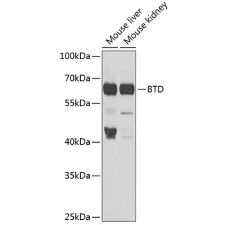Western Blot - Anti-BTD Antibody (A16864) - Antibodies.com