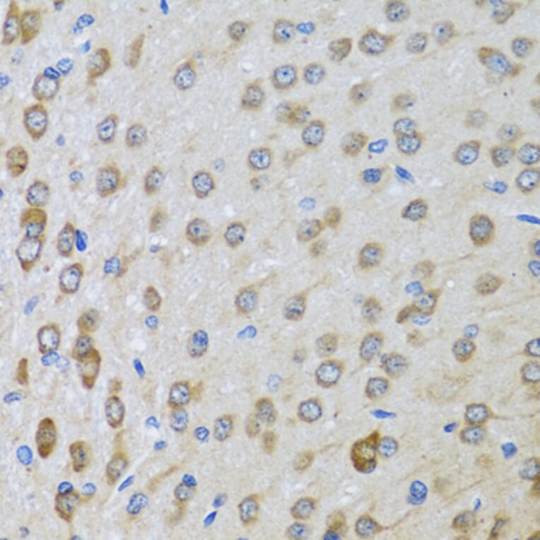 Immunohistochemistry - Anti-BTD Antibody (A16864) - Antibodies.com