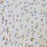 Immunohistochemistry - Anti-BTD Antibody (A16864) - Antibodies.com