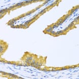 Immunohistochemistry - Anti-BTD Antibody (A16864) - Antibodies.com
