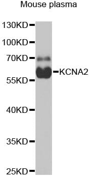 Western blot analysis of extracts of mouse plasma, using Anti-KCNA2 Antibody (A6295) at 1:1,000 dilution.
Secondary antibody: Goat Anti-Rabbit IgG (H+L) (HRP) (AS014) at 1:10,000 dilution.
Lysates / proteins: 25µg per lane.
Blocking buffer: 3% non-fat dry milk in TBST.
Detection: ECL Basic Kit (RM00020).
Exposure time: 90s.
