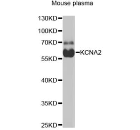 Western Blot - Anti-Kv1.2 Antibody (A16865) - Antibodies.com