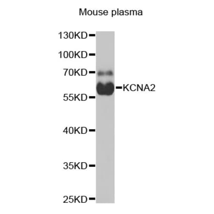 Western Blot - Anti-Kv1.2 Antibody (A16865) - Antibodies.com