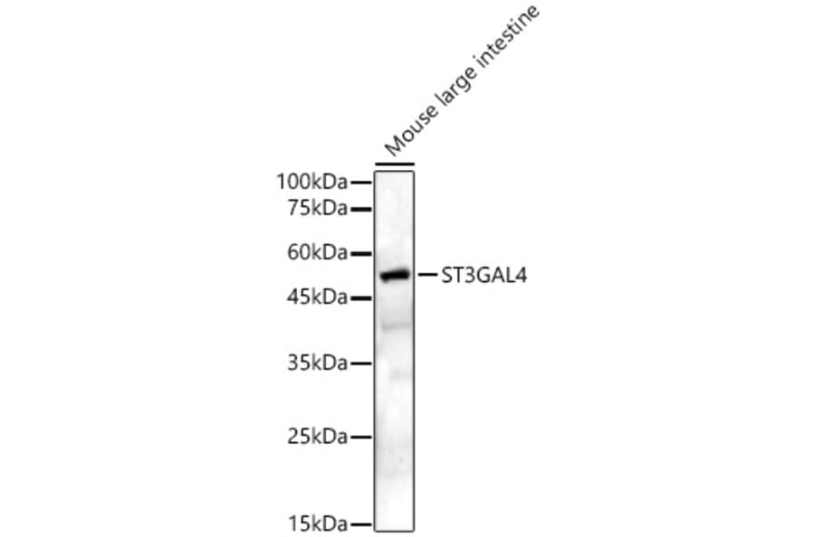 Western Blot - Anti-ST3GAL4/STZ Antibody (A16866) - Antibodies.com