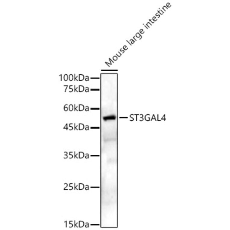 Western Blot - Anti-ST3GAL4/STZ Antibody (A16866) - Antibodies.com