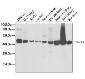 Western Blot - Anti-ACY-1 Antibody (A16867) - Antibodies.com