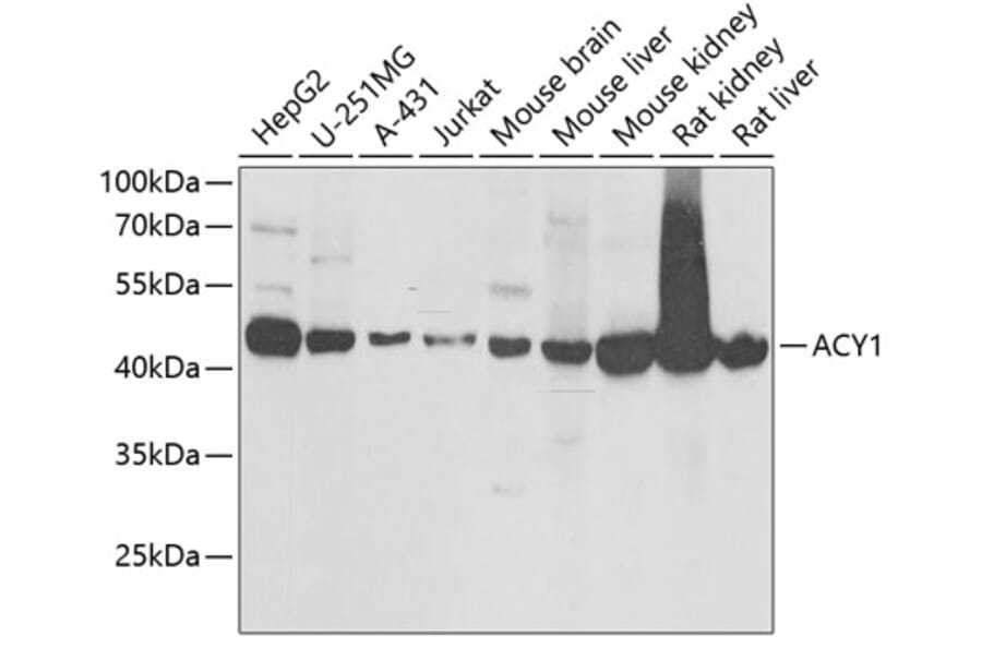 Western Blot - Anti-ACY-1 Antibody (A16867) - Antibodies.com