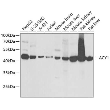 Western Blot - Anti-ACY-1 Antibody (A16867) - Antibodies.com