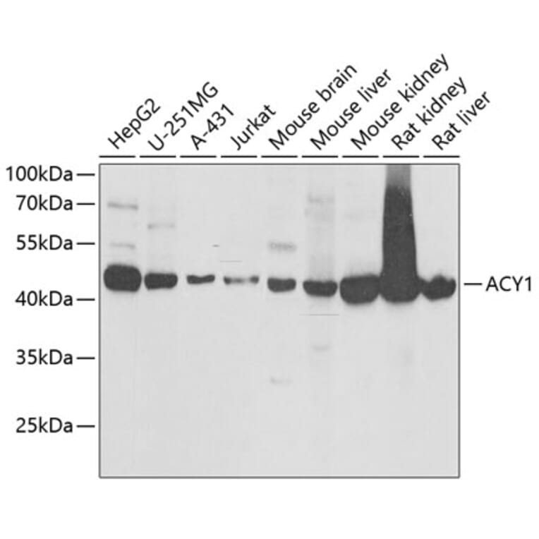 Western Blot - Anti-ACY-1 Antibody (A16867) - Antibodies.com