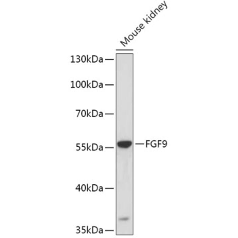 Western Blot - Anti-FGF9/GAF Antibody (A16869) - Antibodies.com