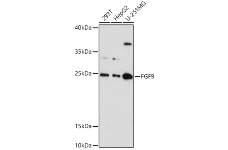 Western Blot - Anti-FGF9/GAF Antibody (A16869) - Antibodies.com