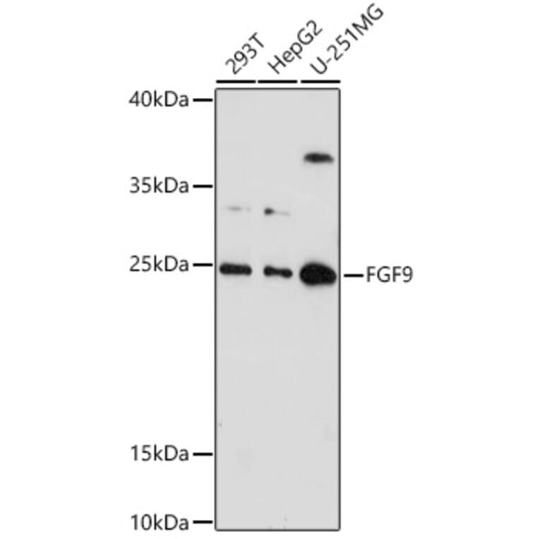 Western Blot - Anti-FGF9/GAF Antibody (A16869) - Antibodies.com