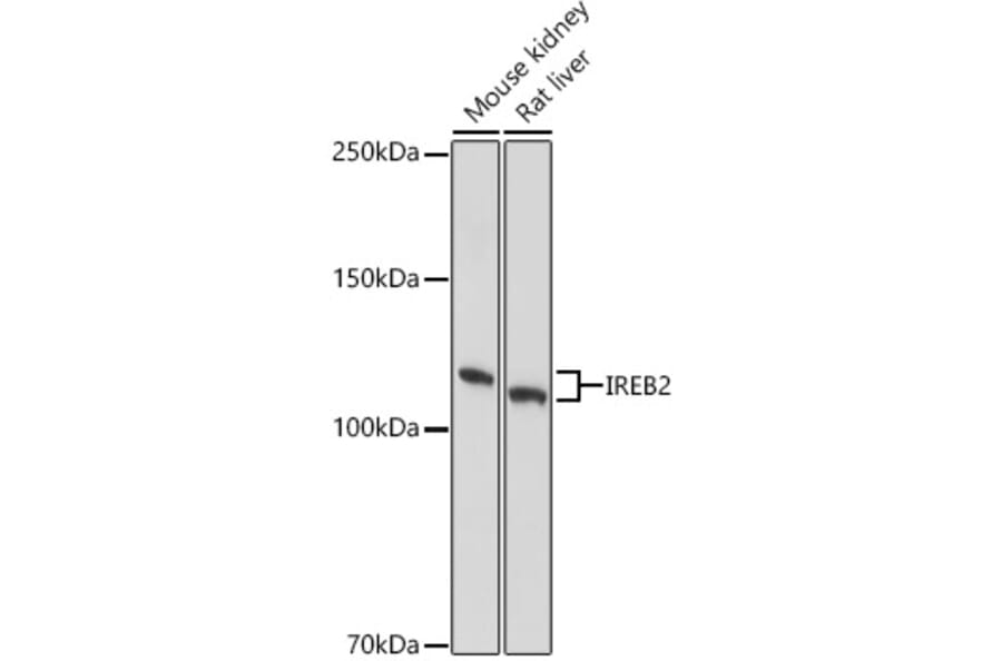 Western Blot - Anti-IREB2/IRP2 Antibody (A16870) - Antibodies.com