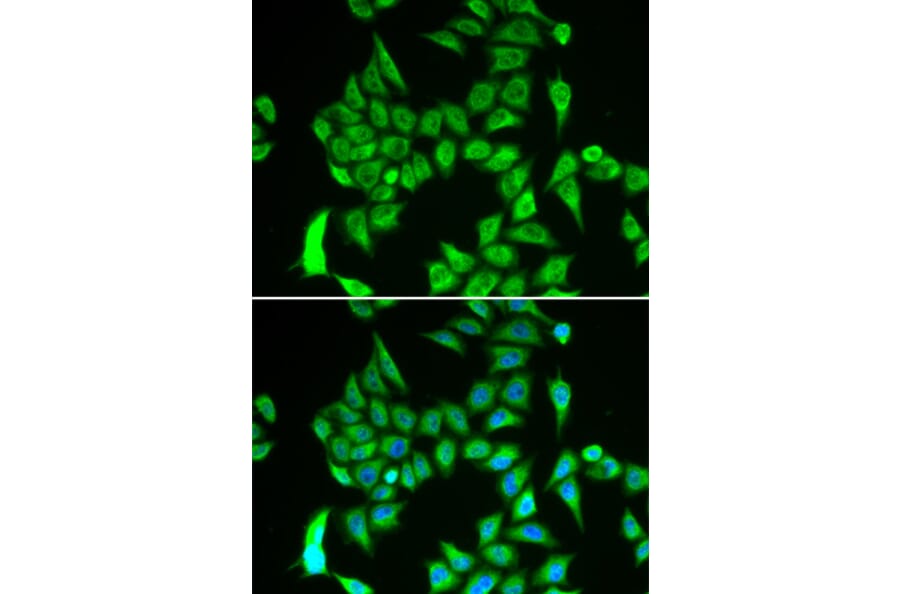 Immunofluorescence - Anti-IREB2/IRP2 Antibody (A16870) - Antibodies.com