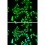Immunofluorescence - Anti-IREB2/IRP2 Antibody (A16870) - Antibodies.com
