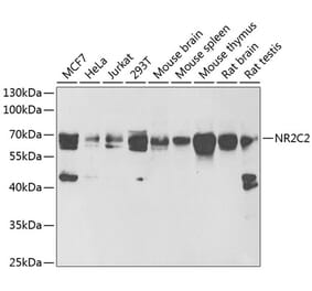 Western Blot - Anti-TR4 Antibody (A16871) - Antibodies.com