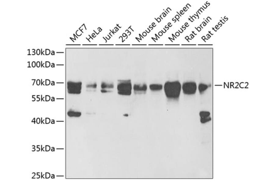 Western Blot - Anti-TR4 Antibody (A16871) - Antibodies.com