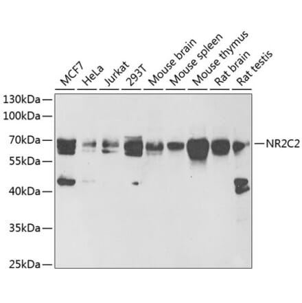 Western Blot - Anti-TR4 Antibody (A16871) - Antibodies.com