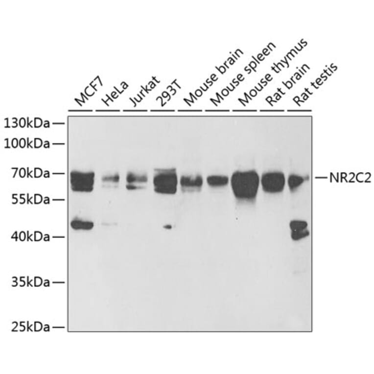 Western Blot - Anti-TR4 Antibody (A16871) - Antibodies.com