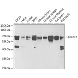 Western Blot - Anti-TR4 Antibody (A16871) - Antibodies.com