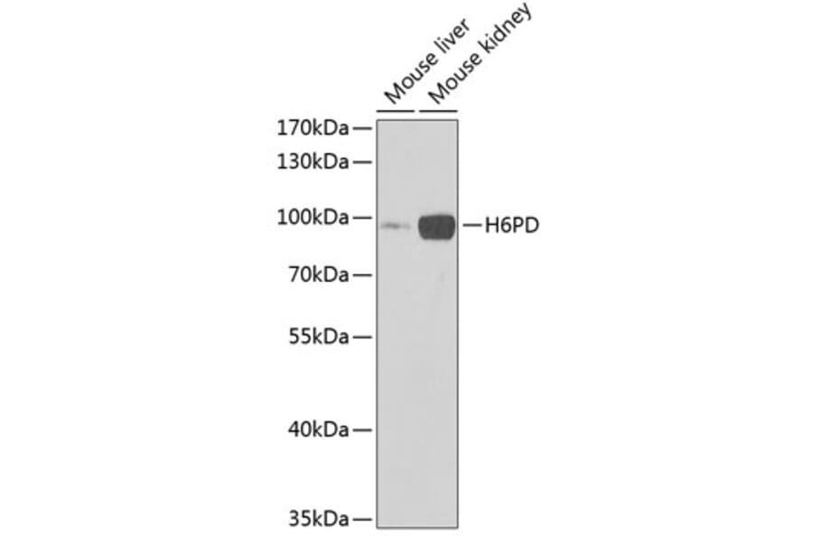 Western Blot - Anti-H6PD/GDH Antibody (A16872) - Antibodies.com