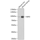 Western Blot - Anti-H6PD/GDH Antibody (A16872) - Antibodies.com