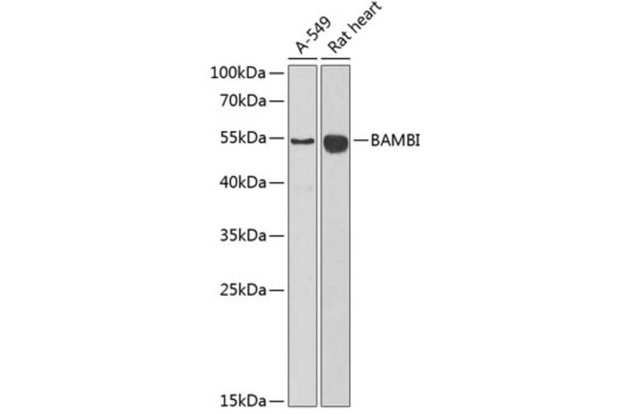 Western Blot - Anti-BAMBI / NMA Antibody (A16873) - Antibodies.com