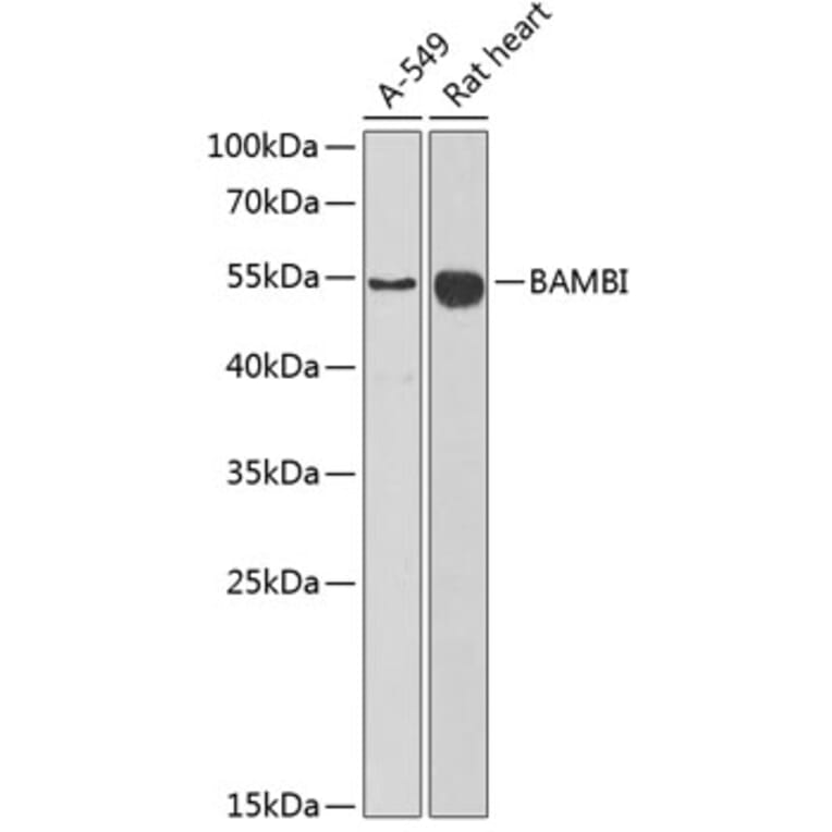 Western Blot - Anti-BAMBI / NMA Antibody (A16873) - Antibodies.com