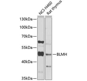 Western Blot - Anti-BLMH Antibody (A16874) - Antibodies.com