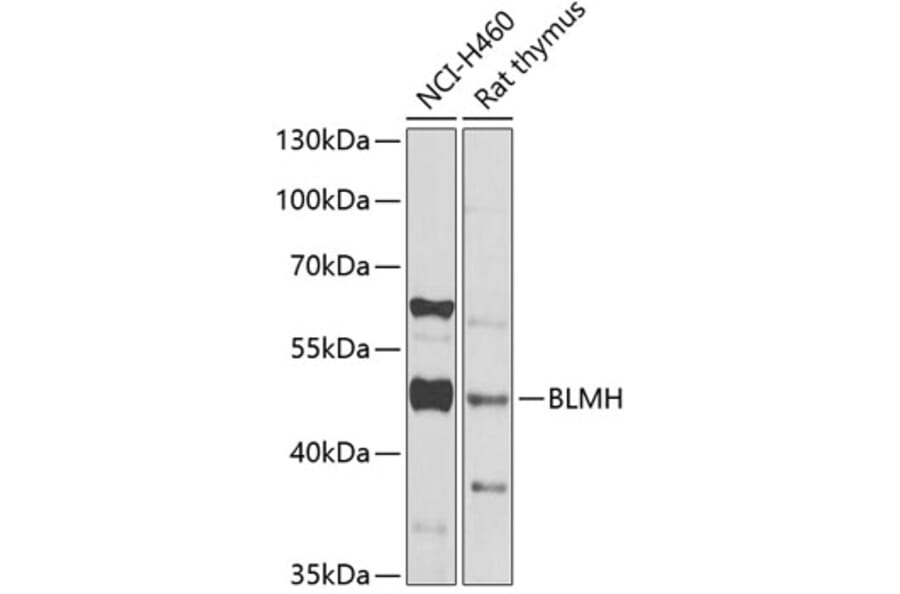 Western Blot - Anti-BLMH Antibody (A16874) - Antibodies.com