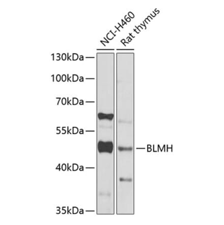 Western Blot - Anti-BLMH Antibody (A16874) - Antibodies.com