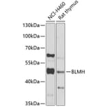 Western Blot - Anti-BLMH Antibody (A16874) - Antibodies.com