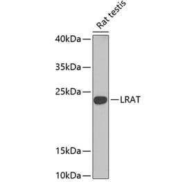 Western Blot - Anti-LRAT Antibody (A16875) - Antibodies.com