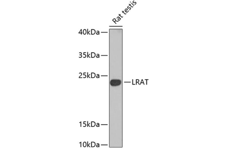 Western Blot - Anti-LRAT Antibody (A16875) - Antibodies.com