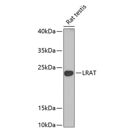 Western Blot - Anti-LRAT Antibody (A16875) - Antibodies.com