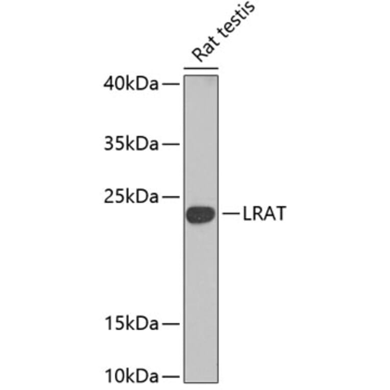 Western Blot - Anti-LRAT Antibody (A16875) - Antibodies.com