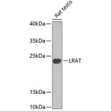 Western Blot - Anti-LRAT Antibody (A16875) - Antibodies.com