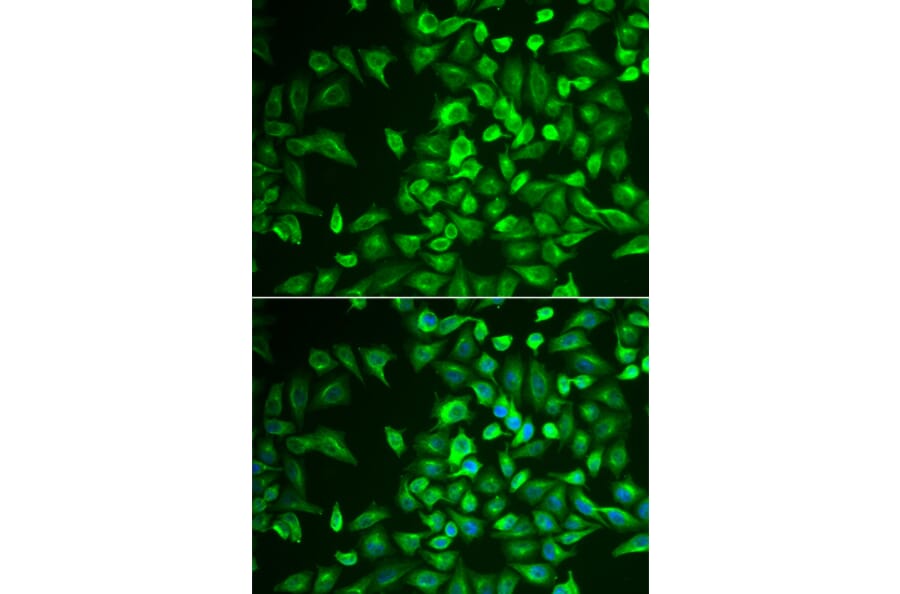 Immunofluorescence - Anti-LRAT Antibody (A16875) - Antibodies.com