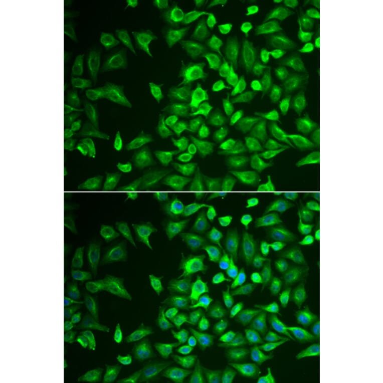 Immunofluorescence - Anti-LRAT Antibody (A16875) - Antibodies.com