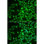 Immunofluorescence - Anti-LRAT Antibody (A16875) - Antibodies.com