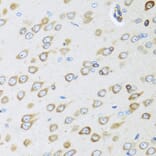 Immunohistochemistry - Anti-OIF Antibody (A16876) - Antibodies.com