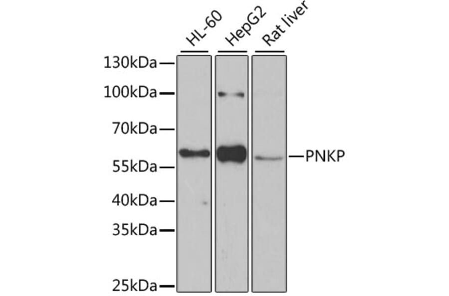 Western Blot - Anti-PNK/PNKP Antibody (A16877) - Antibodies.com