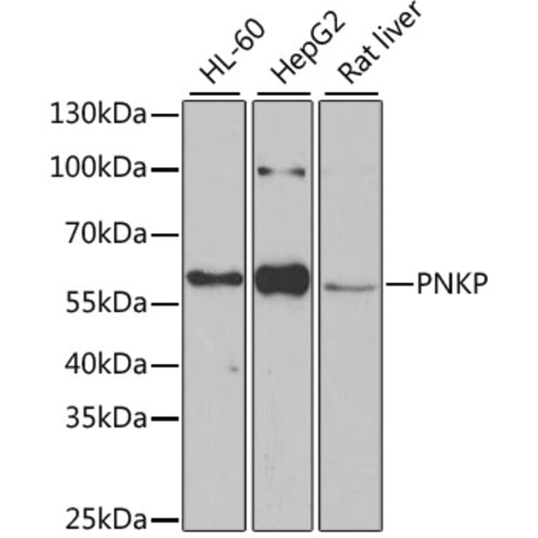 Western Blot - Anti-PNK/PNKP Antibody (A16877) - Antibodies.com