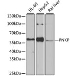 Western Blot - Anti-PNK/PNKP Antibody (A16877) - Antibodies.com