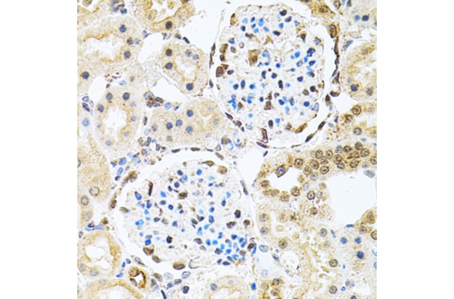 Immunohistochemistry - Anti-PNK/PNKP Antibody (A16877) - Antibodies.com