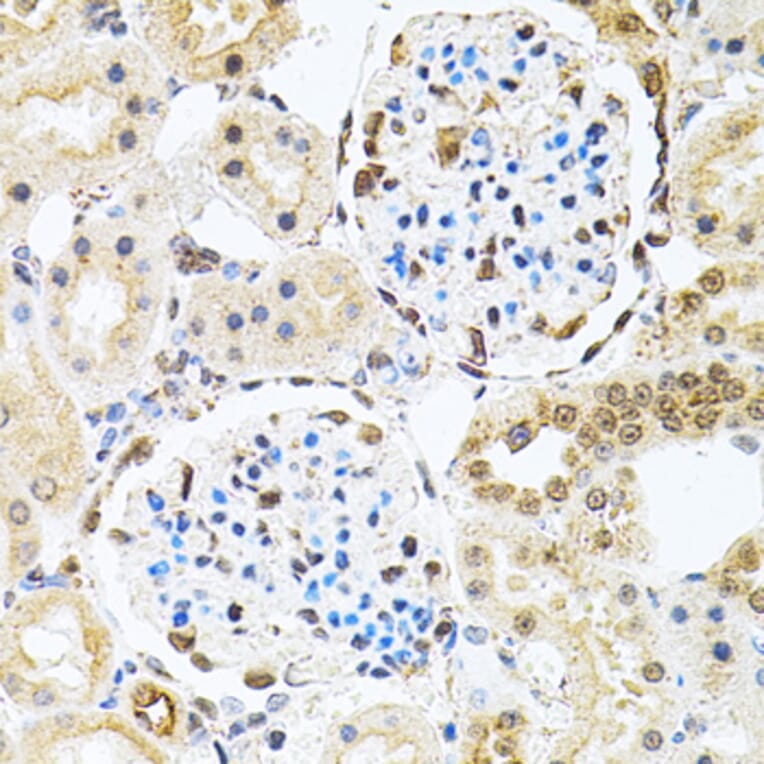 Immunohistochemistry - Anti-PNK/PNKP Antibody (A16877) - Antibodies.com