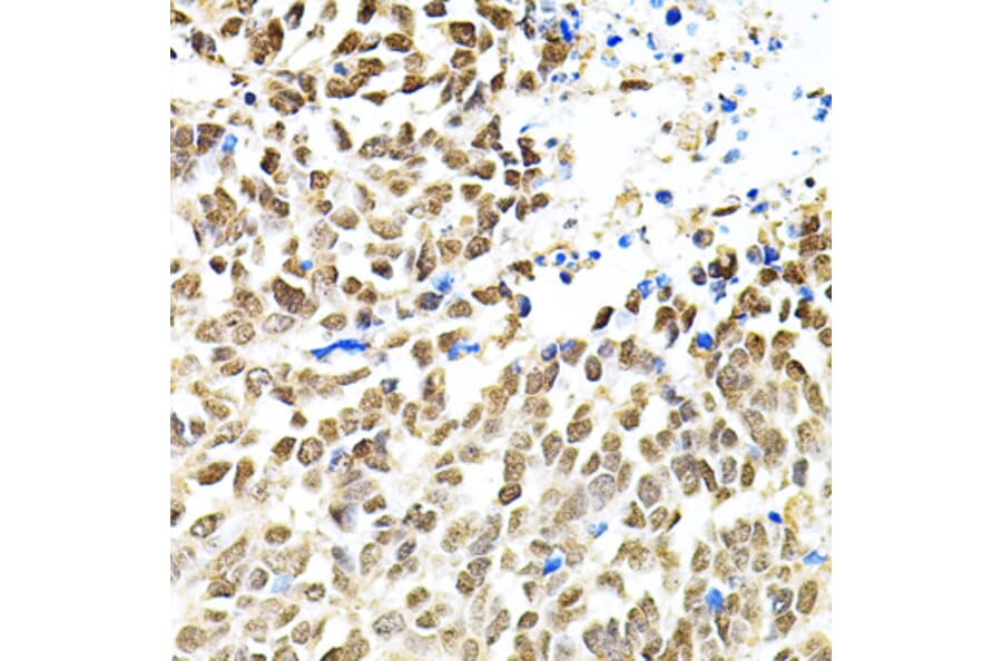 Immunohistochemistry - Anti-PNK/PNKP Antibody (A16877) - Antibodies.com